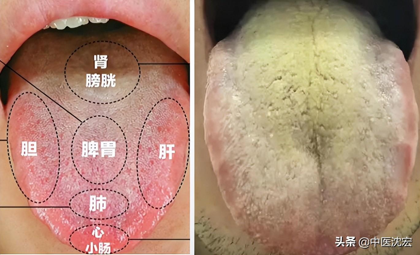 三个月宝宝舌苔厚黄的原因及应对措施